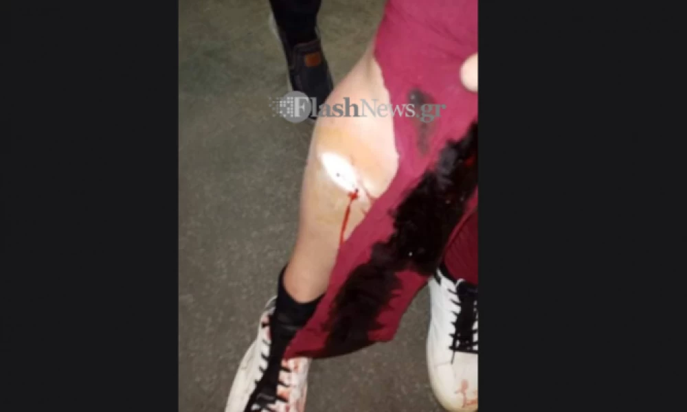 Γυναίκα δέχθηκε επίθεση από σκυλιά στα Χανιά της Κρήτης (εικόνες)